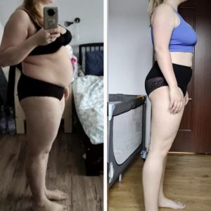 metamorfozy przed i po aplikacja miazga 00098