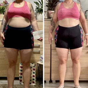 metamorfozy przed i po aplikacja miazga 00101