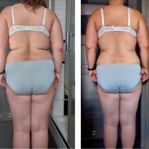 metamorfozy przed i po aplikacja miazga 00102