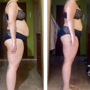 metamorfozy przed i po aplikacja miazga 00104