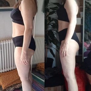 metamorfozy przed i po aplikacja miazga 00107