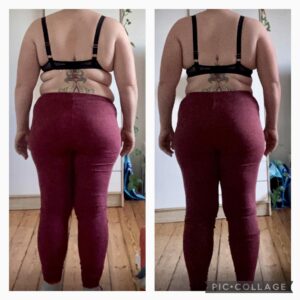 metamorfozy przed i po aplikacja miazga 00109