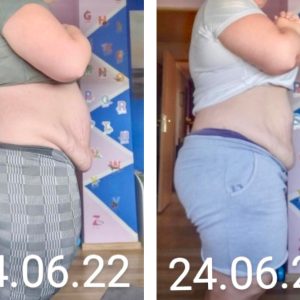 metamorfozy przed i po aplikacja miazga 00111