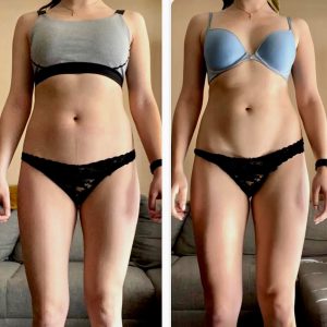 metamorfozy przed i po aplikacja miazga 00112