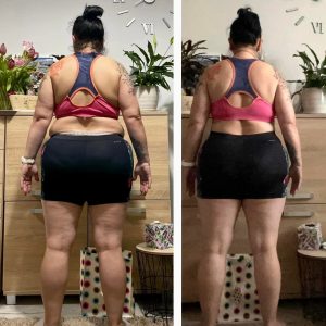 metamorfozy przed i po aplikacja miazga 00115