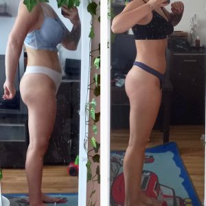 metamorfozy przed i po aplikacja miazga 00117