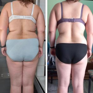 metamorfozy przed i po aplikacja miazga 00119