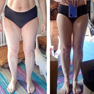 metamorfozy przed i po aplikacja miazga 00121