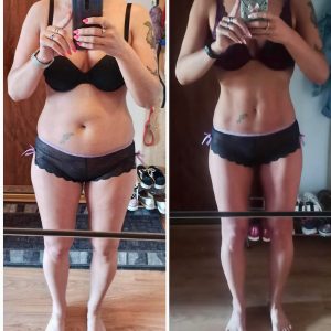 metamorfozy przed i po aplikacja miazga 00122