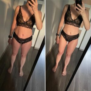 metamorfozy przed i po aplikacja miazga 00124