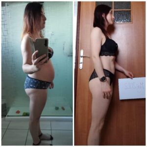 metamorfozy przed i po aplikacja miazga 00126