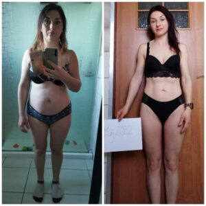 metamorfozy przed i po aplikacja miazga 00127