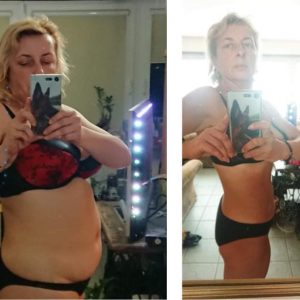 metamorfozy przed i po aplikacja miazga 00128