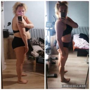 metamorfozy przed i po aplikacja miazga 00129