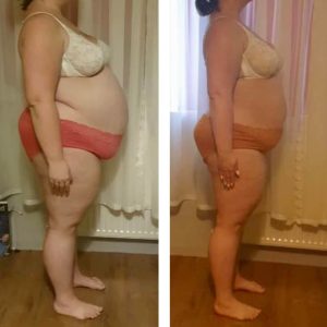 metamorfozy przed i po aplikacja miazga 00130