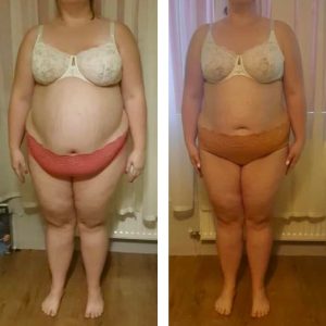 metamorfozy przed i po aplikacja miazga 00132