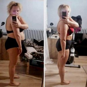 metamorfozy przed i po aplikacja miazga 00133