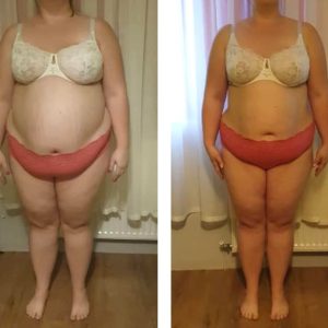 metamorfozy przed i po aplikacja miazga 00135