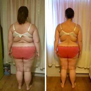 metamorfozy przed i po aplikacja miazga 00136