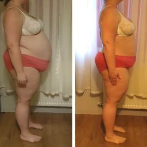 metamorfozy przed i po aplikacja miazga 00137