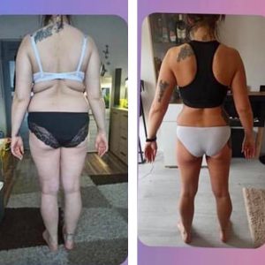 metamorfozy przed i po aplikacja miazga 00138