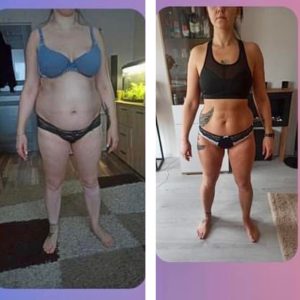 metamorfozy przed i po aplikacja miazga 00139