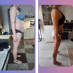 metamorfozy przed i po aplikacja miazga 00140