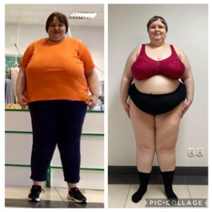 metamorfozy przed i po aplikacja miazga 00141