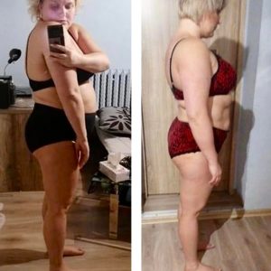 metamorfozy przed i po aplikacja miazga 00142