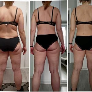 metamorfozy przed i po aplikacja miazga 00144