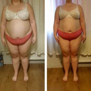 metamorfozy przed i po aplikacja miazga 00145