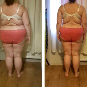 metamorfozy przed i po aplikacja miazga 00147