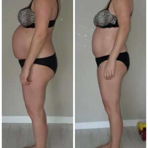 metamorfozy przed i po aplikacja miazga 00150