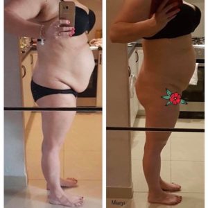 metamorfozy przed i po aplikacja miazga 00153