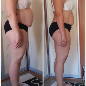 metamorfozy przed i po aplikacja miazga 00154