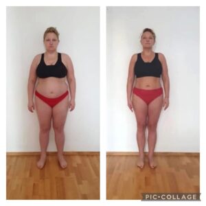 metamorfozy przed i po aplikacja miazga 00155