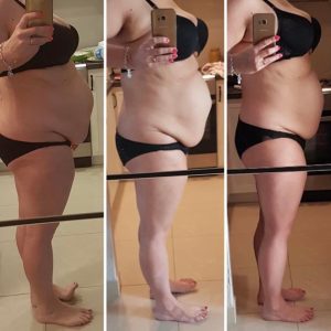 metamorfozy przed i po aplikacja miazga 00158