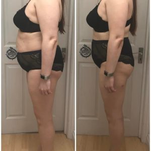 metamorfozy przed i po aplikacja miazga 00160