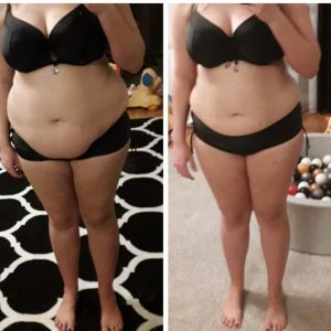 metamorfozy przed i po aplikacja miazga 00161