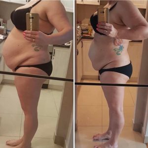 metamorfozy przed i po aplikacja miazga 00162