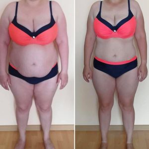 metamorfozy przed i po aplikacja miazga 00164