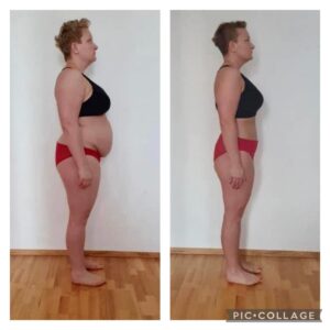 metamorfozy przed i po aplikacja miazga 00167