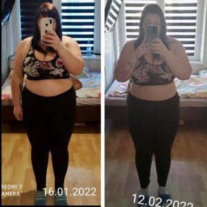 metamorfozy przed i po aplikacja miazga 00178