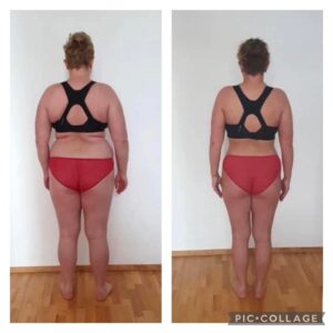 metamorfozy przed i po aplikacja miazga 00183