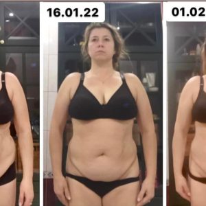 metamorfozy przed i po aplikacja miazga 00185