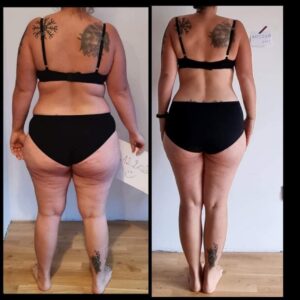 metamorfozy przed i po aplikacja miazga 00188