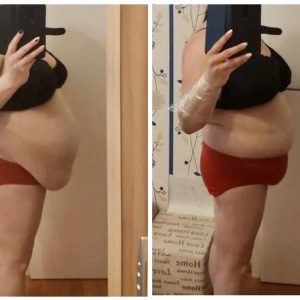 metamorfozy przed i po aplikacja miazga 00189