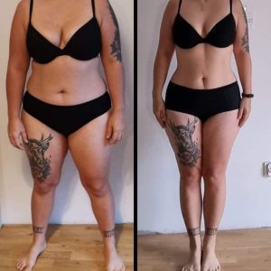 metamorfozy przed i po aplikacja miazga 00191