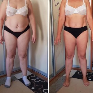 metamorfozy przed i po aplikacja miazga 00193