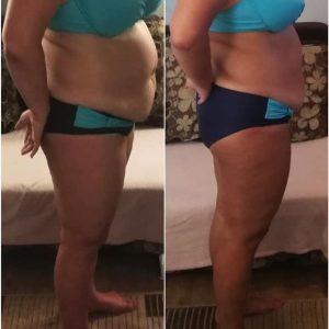 metamorfozy przed i po aplikacja miazga 00194